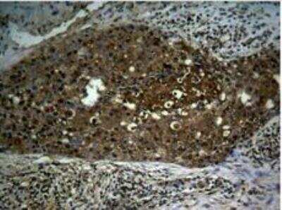 Immunohistochemistry-Paraffin: RelA/NFkB p65 [p Ser276] Antibody [NB100-82086]